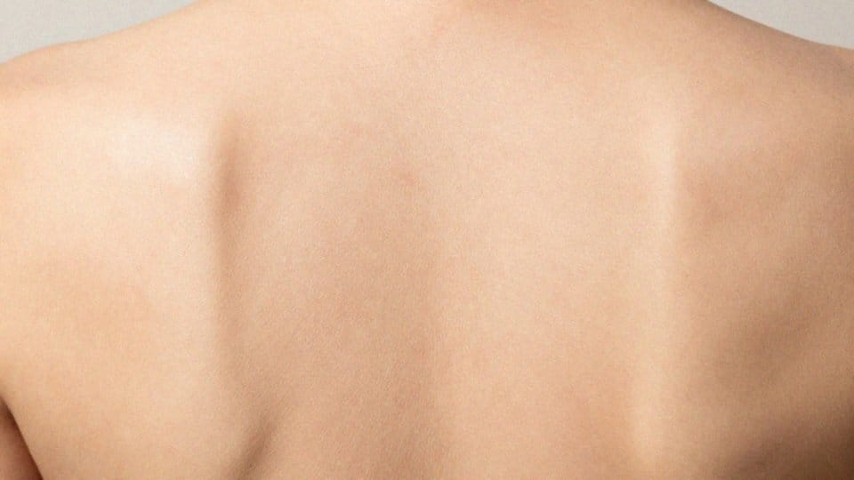 Jak wyglądają plamy i odbarwienia skóry?